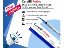 Cerafill Putty - Bioceramic Material for Permanent Root Repair - 2g - Prevest Denpro