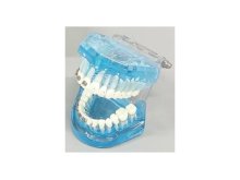 Oktató modell - M3003 - Orthodontic modell with metal and ceramic bracket