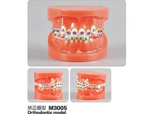 Oktató modell - M3005 - Orthodontic modell