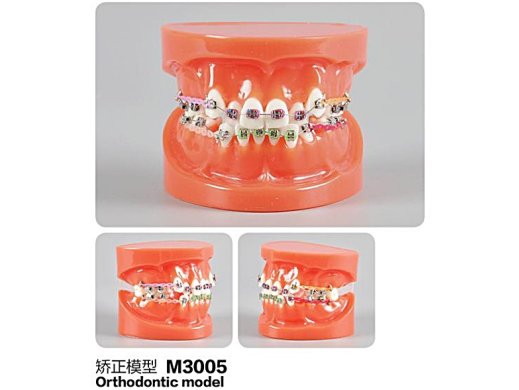Oktató modell - M3005 - Orthodontic modell