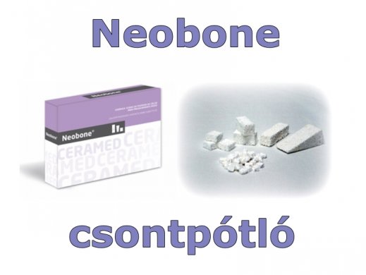 Csontpótló - Neobone - 355-500 micron - 2g