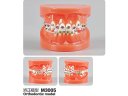 Oktató modell - M3005 - Orthodontic modell